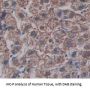 Aspartate Beta Hydroxylase (ASPH) Antibody