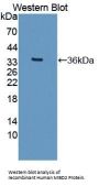 Methyl CpG Binding Domain Protein 2 (MBD2) Antibody