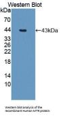 5-Methyltetrahydrofolate Homocysteine Methyltransferase (MTR) Antibody