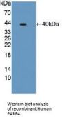 Poly ADP Ribose Polymerase 4 Antibody