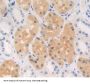 Poly ADP Ribose Polymerase 4 Antibody