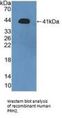 Salivary Acidic Proline-Rich Phosphoprotein 1/2 (PRH1/2) Antibody