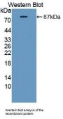 Carnitine Palmitoyltransferase 2, Mitochondrial (CPT2) Antibody