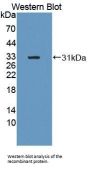 Methylthioadenosine Phosphorylase (MTAP) Antibody