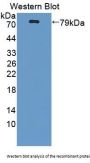 Protoporphyrinogen Oxidase (PPOX) Antibody