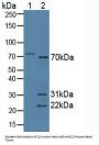 Syncoilin (SYNC) Antibody