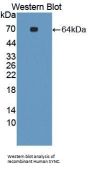 Syncoilin (SYNC) Antibody