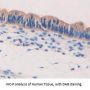 Syncoilin (SYNC) Antibody