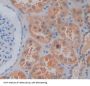 Aminoacylase 1 Antibody