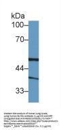 Biliverdin Reductase A (BLVRA) Antibody