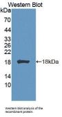 Biliverdin Reductase A (BLVRA) Antibody