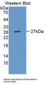 UL16 Binding Protein 2 (ULBP2) Antibody