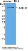 Surfactant Associated Protein A Antibody