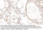 Surfactant Associated Protein A Antibody