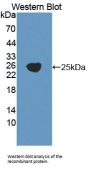 Gamma-Glutamyltransferase 5 (gGT5) Antibody