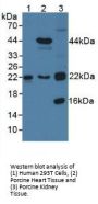 Transgelin 2 (TAGLN2) Antibody