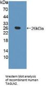 Transgelin 2 (TAGLN2) Antibody