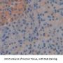 Transgelin 2 (TAGLN2) Antibody