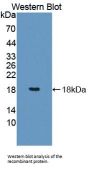 Programmed Cell Death Protein 5 (PDCD5) Antibody