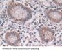 Ring Finger Protein 55 (RNF55) Antibody