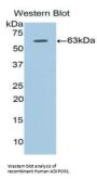 Adiponectin Receptor 1 (ADIPOR1) Antibody