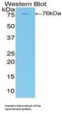 Phospholipase A2 Activating Protein (PLAA) Antibody