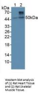 Bone Morphogenetic Protein 4 (BMP4) Antibody