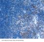 Macrophage Inflammatory Protein 1 Alpha (MIP1a) Antibody