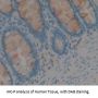 Carcinoembryonic Antigen-Related Cell Adhesion Molecule 5 (CEACAM5) Antibody
