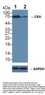 Carcinoembryonic Antigen-Related Cell Adhesion Molecule 5 (CEACAM5) Antibody