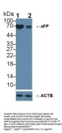 Alpha Fetoprotein (AFP) Antibody