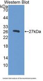Alpha Fetoprotein (AFP) Antibody