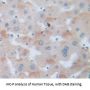 Alpha Fetoprotein (AFP) Antibody