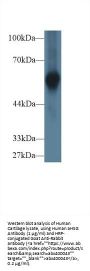 Alpha-2-Heremans Schmid Glycoprotein (AHSG) Antibody