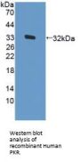 Protein Kinase R (PKR) Antibody