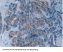 Protein Kinase R (PKR) Antibody