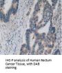 Pyruvate Kinase, Muscle (PKM2) Antibody