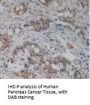 Pyruvate Kinase, Muscle (PKM2) Antibody