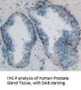 Pyruvate Kinase, Muscle (PKM2) Antibody