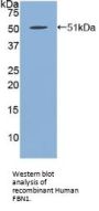 Fibrillin 1 (FBN1) Antibody