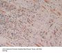 Cytochrome C, Somatic Antibody