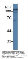 Hexosaminidase B Beta (HEXb) Antibody