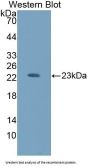 Hexosaminidase B Beta (HEXb) Antibody