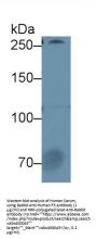 Coagulation Factor V (F5) Antibody