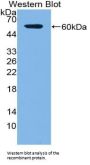 Tartrate-Resistant Acid Phosphatase 5 / TRACP5 (ACP5) Antibody