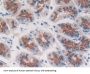 Tartrate-Resistant Acid Phosphatase 5 / TRACP5 (ACP5) Antibody