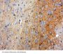 Tartrate-Resistant Acid Phosphatase 5 / TRACP5 (ACP5) Antibody