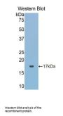 Acid Phosphatase 1 (ACP1) Antibody