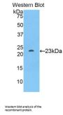 Sialic Acid Binding Ig Like Lectin 12 (SIGLEC12) Antibody