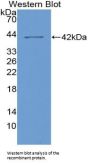 Colony Stimulating Factor 2 Receptor Alpha (CSF2Ra) Antibody